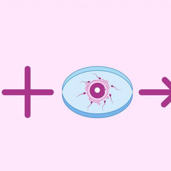 ЭКО с донорской яйцеклеткой